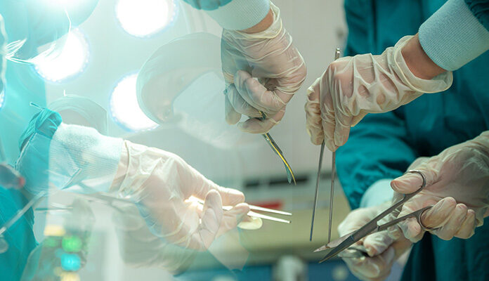 Afbeelding van een operatie